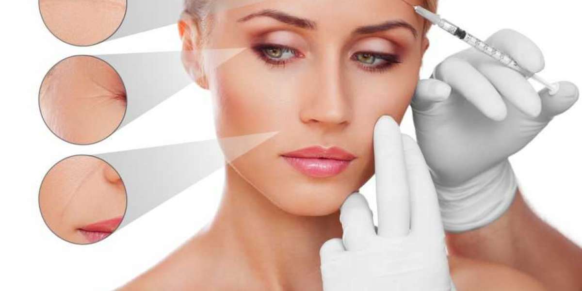 Say Goodbye to Wrinkles: How Allergan Botox Transforms Your Skin!