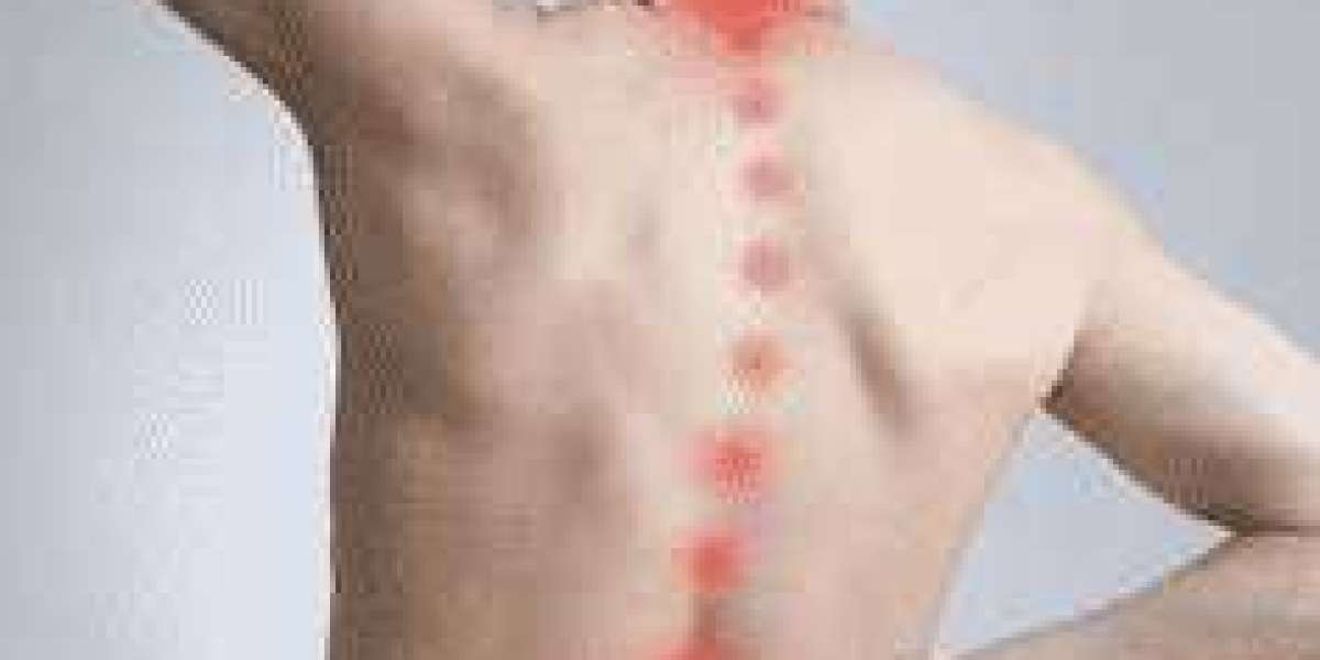 Things to Know Before Taking Aspadol 100mg for Pain Relief